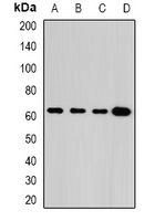 GLUD2 Antibody - Western blot analysis of GLUD2 expression in MCF7 (A); A431 (B); mouse brain (C); rat testis (D) whole cell lysates.