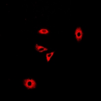 GLUD2 Antibody - Immunofluorescent analysis of GLUD2 staining in A549 cells. Formalin-fixed cells were permeabilized with 0.1% Triton X-100 in TBS for 5-10 minutes and blocked with 3% BSA-PBS for 30 minutes at room temperature. Cells were probed with the primary antibody in 3% BSA-PBS and incubated overnight at 4 deg C in a humidified chamber. Cells were washed with PBST and incubated with a DyLight 594-conjugated secondary antibody (red) in PBS at room temperature in the dark.