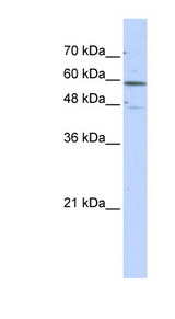 GLUD2 Antibody - GLUD2 antibody Western blot of Transfected 293T cell lysate. This image was taken for the unconjugated form of this product. Other forms have not been tested.