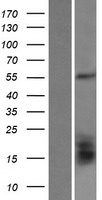 GLUD2 Protein - Western validation with an anti-DDK antibody * L: Control HEK293 lysate R: Over-expression lysate