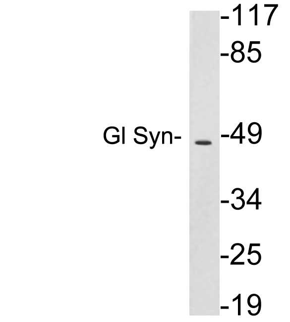 GLUL / Glutamine Synthetase Antibody - Western blot analysis of lysates from HepG2 cells , using Gl Syn antibody.