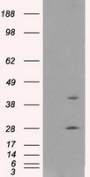 GLUL / Glutamine Synthetase Antibody - HEK293T cells were transfected with the pCMV6-ENTRY control (Left lane) or pCMV6-ENTRY GLUL (Right lane) cDNA for 48 hrs and lysed. Equivalent amounts of cell lysates (5 ug per lane) were separated by SDS-PAGE and immunoblotted with anti-GLUL.