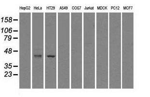 GLUL / Glutamine Synthetase Antibody - Western blot analysis of extracts (35ug) from 9 different cell lines by using anti-GLUL monoclonal antibody.
