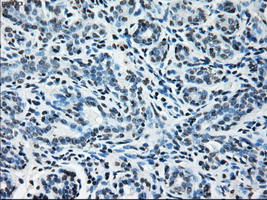 GLUL / Glutamine Synthetase Antibody - Immunohistochemical staining of paraffin-embedded breast tissue using anti-GLUL mouse monoclonal antibody. (Dilution 1:50).