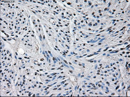 GLUL / Glutamine Synthetase Antibody - Immunohistochemical staining of paraffin-embedded endometrium tissue using anti-GLUL mouse monoclonal antibody. (Dilution 1:50).