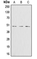 GLUL / Glutamine Synthetase Antibody - Western blot analysis of Glutamine Synthetase expression in Jurkat (A); HeLa (B); HT29 (C) whole cell lysates.