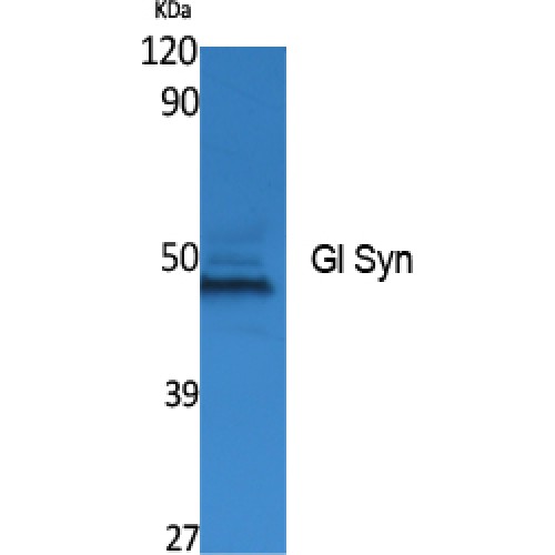 GLUL / Glutamine Synthetase Antibody - Western blot of Gl Syn antibody