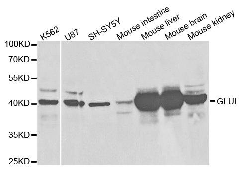GLUL / Glutamine Synthetase Antibody - Western blot analysis of extracts of various cell lines.