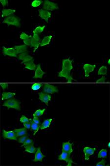 GLUL / Glutamine Synthetase Antibody - Immunofluorescence analysis of MCF-7 cells.