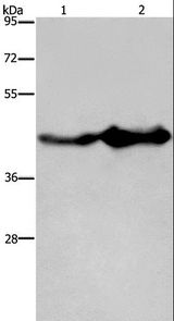 GLUL / Glutamine Synthetase Antibody - Western blot analysis of Mouse liver and brain tissue, using GLUL Polyclonal Antibody at dilution of 1:600.
