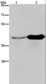 GLUL / Glutamine Synthetase Antibody - Western blot analysis of Mouse liver and brain tissue, using GLUL Polyclonal Antibody at dilution of 1:650.