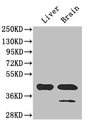 GLUL / Glutamine Synthetase Antibody - Western Blot Positive WB detected in:mouse liver tissue,mouse brain tissue All Lanes: GLUL antibody at 3ug/ml Secondary Goat polyclonal to rabbit IgG at 1/50000 dilution Predicted band size: 42 kDa Observed band size: 42 kDa