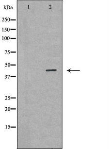 GLUL / Glutamine Synthetase Antibody - Western blot analysis of mouse liver tissue lysates using GLUL antibody. The lane on the left is treated with the antigen-specific peptide.