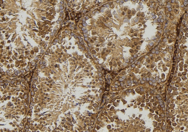 GLUL / Glutamine Synthetase Antibody - 1:100 staining mouse testis tissue by IHC-P. The sample was formaldehyde fixed and a heat mediated antigen retrieval step in citrate buffer was performed. The sample was then blocked and incubated with the antibody for 1.5 hours at 22°C. An HRP conjugated goat anti-rabbit antibody was used as the secondary.