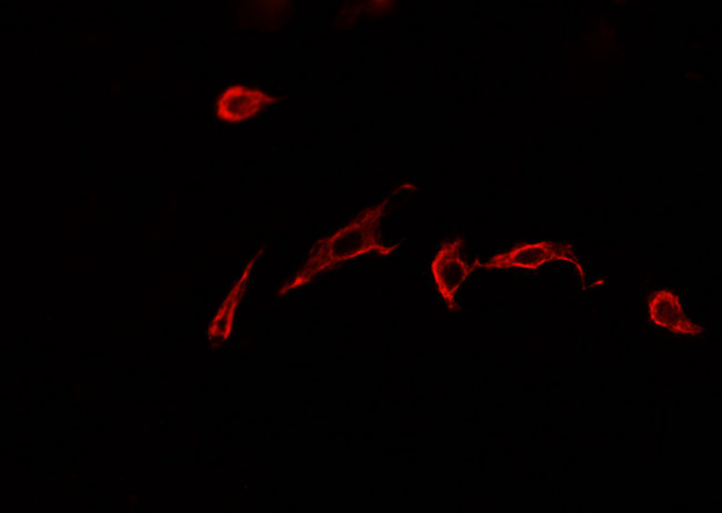 GLUL / Glutamine Synthetase Antibody - Staining HepG2 cells by IF/ICC. The samples were fixed with PFA and permeabilized in 0.1% Triton X-100, then blocked in 10% serum for 45 min at 25°C. The primary antibody was diluted at 1:200 and incubated with the sample for 1 hour at 37°C. An Alexa Fluor 594 conjugated goat anti-rabbit IgG (H+L) antibody, diluted at 1/600, was used as secondary antibody.