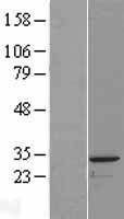 GLUP / PACRG Protein - Western validation with an anti-DDK antibody * L: Control HEK293 lysate R: Over-expression lysate