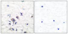 GLUR2 + GLUR3 Antibody - Immunohistochemistry analysis of paraffin-embedded human brain tissue, using mGluR2/3 Antibody. The picture on the right is blocked with the synthesized peptide.