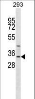 GLYAT Antibody - GLYAT Antibody western blot of 293 cell line lysates (35 ug/lane). The GLYAT antibody detected the GLYAT protein (arrow).