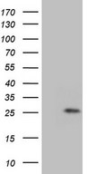 GLYAT Antibody - HEK293T cells were transfected with the pCMV6-ENTRY control. (Left lane) or pCMV6-ENTRY GLYAT. (Right lane) cDNA for 48 hrs and lysed. Equivalent amounts of cell lysates. (5 ug per lane) were separated by SDS-PAGE and immunoblotted with anti-GLYAT. (1:2000)