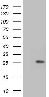 GLYAT Antibody - HEK293T cells were transfected with the pCMV6-ENTRY control. (Left lane) or pCMV6-ENTRY GLYAT. (Right lane) cDNA for 48 hrs and lysed