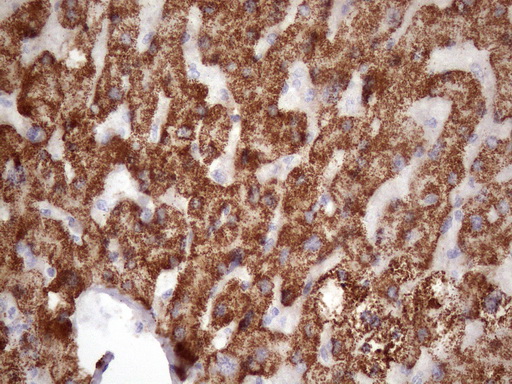 GLYAT Antibody - Immunohistochemical staining of paraffin-embedded Human liver tissue within the normal limits using anti-GLYAT mouse monoclonal antibody. (Heat-induced epitope retrieval by 1mM EDTA in 10mM Tris buffer. (pH8.5) at 120 oC for 3 min. (1:150)