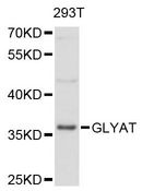 GLYAT Antibody - Western blot analysis of extracts of 293T cells, using GLYAT antibody at 1:3000 dilution. The secondary antibody used was an HRP Goat Anti-Rabbit IgG (H+L) at 1:10000 dilution. Lysates were loaded 25ug per lane and 3% nonfat dry milk in TBST was used for blocking. An ECL Kit was used for detection and the exposure time was 30s.