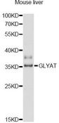 GLYAT Antibody - Western blot analysis of extracts of mouse liver, using GLYAT antibody at 1:3000 dilution. The secondary antibody used was an HRP Goat Anti-Rabbit IgG (H+L) at 1:10000 dilution. Lysates were loaded 25ug per lane and 3% nonfat dry milk in TBST was used for blocking. An ECL Kit was used for detection and the exposure time was 30s.