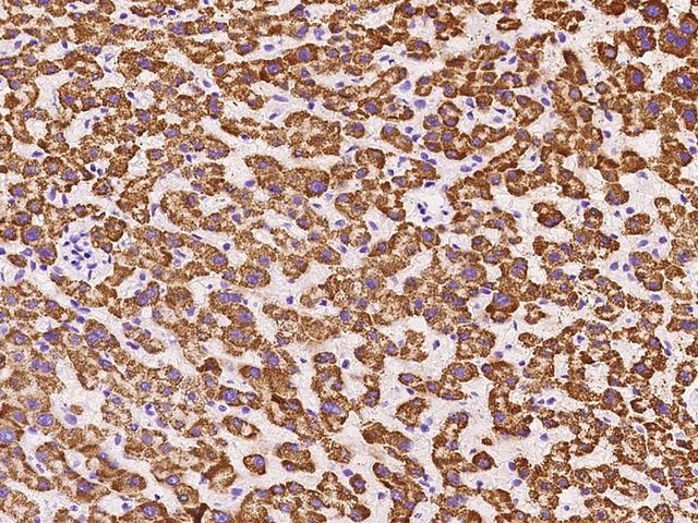 GLYAT Antibody - Immunochemical staining of human GLYAT in human liver with rabbit polyclonal antibody at 1:1000 dilution, formalin-fixed paraffin embedded sections.