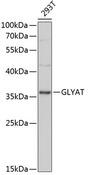 GLYAT Antibody - Western blot analysis of extracts of 293T cells using GLYAT Polyclonal Antibody at dilution of 1:3000.