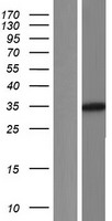 GLYAT Protein - Western validation with an anti-DDK antibody * L: Control HEK293 lysate R: Over-expression lysate