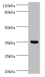 GLYATL1 Antibody - Western blot All lanes: GLYATL1 antibody at 8µg/ml + Rat liver tissue Secondary Goat polyclonal to rabbit IgG at 1/10000 dilution Predicted band size: 36, 39 kDa Observed band size: 36 kDa