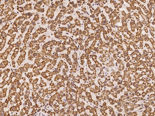 GLYATL1 Antibody - Immunochemical staining of human GLYATL1 in human liver with rabbit polyclonal antibody at 1:100 dilution, formalin-fixed paraffin embedded sections.