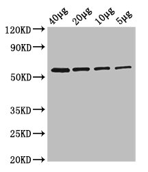 Glycerol Kinase Antibody - Western Blot Positive WB detected in: Rosseta bacteria lysate at 40µg, 20µg, 10µg, 5µg All lanes: glpK antibody at 2.5µg/ml Secondary Goat polyclonal to rabbit IgG at 1/50000 dilution Predicted band size: 57 kDa Observed band size: 57 kDa