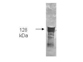 Glycerol Kinase Antibody - Both the antiserum and IgG fractions of anti-Glycerol Kinase (Cellulomonas) are shown to detect the 128,000 dalton enzyme in cellular extracts. Approximately 10 ug of total protein is loaded per lane. A 1:4,000 dilution of the primary antibody is used followed by detection using HRP Rabbit-a-Goat IgG [H&L] diluted 1:4,000 and color development using 4-CN substrate until sufficient color develops. Other detection systems will yield similar results.