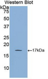 Glycocalicin Antibody - Western blot of recombinant GC / Vitamin D-Binding Protein.  This image was taken for the unconjugated form of this product. Other forms have not been tested.