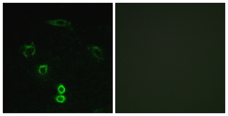 GLYCTK / Glycerate Kinase Antibody - Immunofluorescence analysis of A549 cells, using GLCTK Antibody. The picture on the right is blocked with the synthesized peptide.