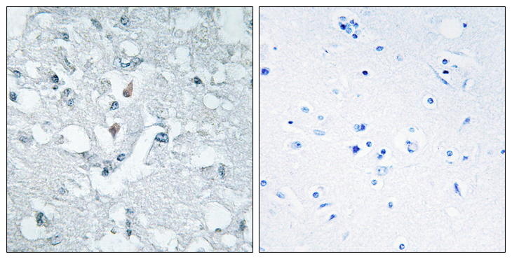 GLYCTK / Glycerate Kinase Antibody - Immunohistochemistry analysis of paraffin-embedded human brain tissue, using GLCTK Antibody. The picture on the right is blocked with the synthesized peptide.