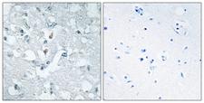 GLYCTK / Glycerate Kinase Antibody - Immunohistochemistry analysis of paraffin-embedded human brain tissue, using GLCTK Antibody. The picture on the right is blocked with the synthesized peptide.