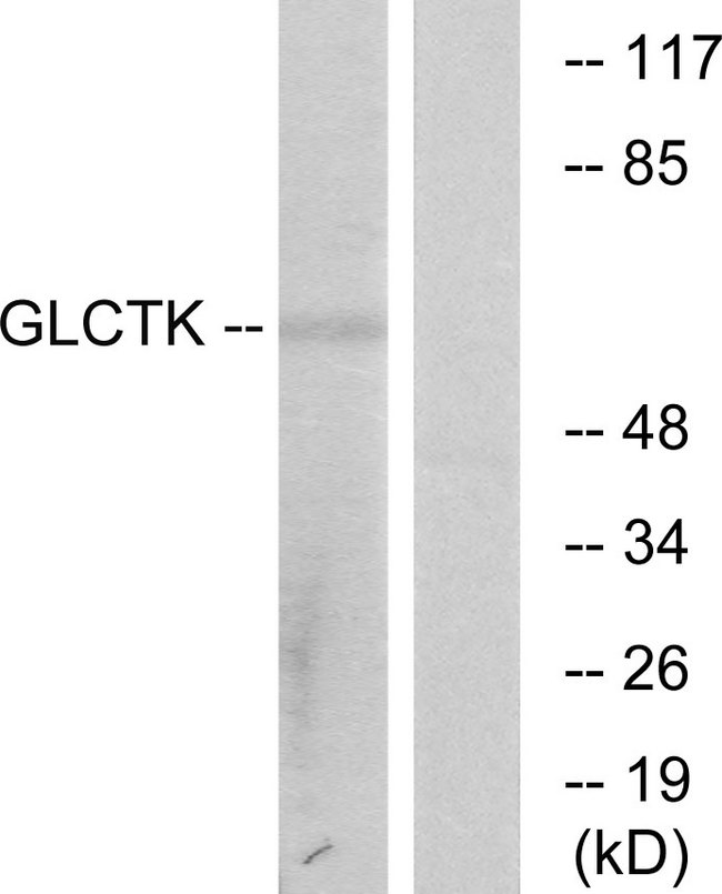 GLYCTK / Glycerate Kinase Antibody - Western blot analysis of lysates from NIH/3T3 cells, using GLCTK Antibody. The lane on the right is blocked with the synthesized peptide.