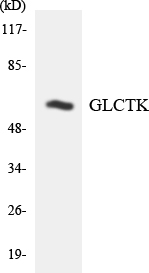 GLYCTK / Glycerate Kinase Antibody - Western blot analysis of the lysates from HUVECcells using GLCTK antibody.