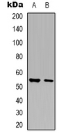 GLYCTK / Glycerate Kinase Antibody - Western blot analysis of Glycerate Kinase expression in HepG2 (A); NIH3T3 (B) whole cell lysates.