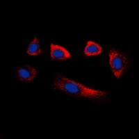 GLYCTK / Glycerate Kinase Antibody - Immunofluorescent analysis of Glycerate Kinase staining in HepG2 cells. Formalin-fixed cells were permeabilized with 0.1% Triton X-100 in TBS for 5-10 minutes and blocked with 3% BSA-PBS for 30 minutes at room temperature. Cells were probed with the primary antibody in 3% BSA-PBS and incubated overnight at 4 deg C in a humidified chamber. Cells were washed with PBST and incubated with a DyLight 594-conjugated secondary antibody (red) in PBS at room temperature in the dark. DAPI was used to stain the cell nuclei (blue).