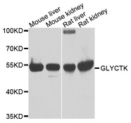 GLYCTK / Glycerate Kinase Antibody - Western blot analysis of extracts of various cells.