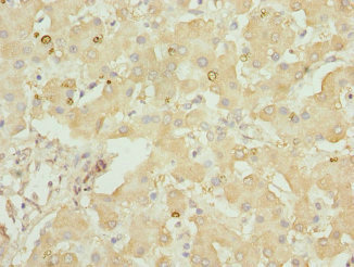GLYCTK / Glycerate Kinase Antibody - Immunohistochemistry of paraffin-embedded human liver tissue at dilution 1:100