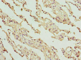 GLYCTK / Glycerate Kinase Antibody - Immunohistochemistry of paraffin-embedded human lung tissue at dilution 1:100