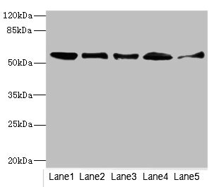 GLYCTK / Glycerate Kinase Antibody - Western blot All Lanes: GLYCTKantibody at 5.43ug/ml Lane 1 : Mouse liver tissue Lane 2 : Mouse lung tissue Lane 3 : Mouse kidney tissue Lane 4 : Rat lung tissue Lane 5 : NIH/3T3 whole cell lysate Secondary Goat polyclonal to Rabbit IgG at 1/10000 dilution Predicted band size: 56,26,49,39,20,23 kDa Observed band size: 55 kDa