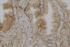 GLYCTK / Glycerate Kinase Antibody - 1:100 staining mouse colon tissue by IHC-P. The sample was formaldehyde fixed and a heat mediated antigen retrieval step in citrate buffer was performed. The sample was then blocked and incubated with the antibody for 1.5 hours at 22°C. An HRP conjugated goat anti-rabbit antibody was used as the secondary.