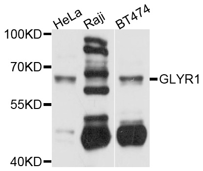 GLYR1 Antibody - Western blot analysis of extracts of various cell lines.