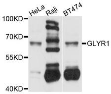 GLYR1 Antibody - Western blot analysis of extracts of various cell lines.