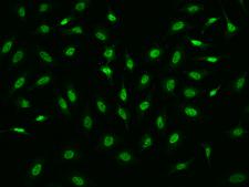 GLYR1 Antibody - Immunofluorescence staining of GLYR1 in HeLa cells. Cells were fixed with 4% PFA, permeabilzed with 0.1% Triton X-100 in PBS, blocked with 10% serum, and incubated with rabbit anti-Human GLYR1 polyclonal antibody (dilution ratio 1:1000) at 4°C overnight. Then cells were stained with the Alexa Fluor 488-conjugated Goat Anti-rabbit IgG secondary antibody (green). Positive staining was localized to Nucleus.